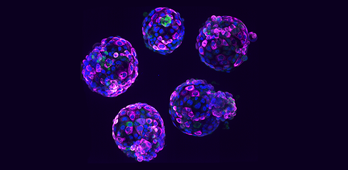Human stem cell-based embryo model – Blastoids. Blue marks all nuclei, the green label marks cells of the inner cell mass, and the pink label is a readout of a ribosomal protein. Credit Irene Zorzan and Teresa Rayon, Babraham Institute.