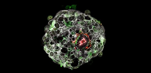 A human embryo in the lab at 9 days post-fertilisation