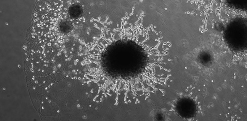 Organoid