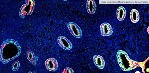 Uterine cells
