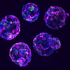 Human stem cell-based embryo model – Blastoids. Blue marks all nuclei, the green label marks cells of the inner cell mass, and the pink label is a readout of a ribosomal protein. Credit Irene Zorzan and Teresa Rayon, Babraham Institute.