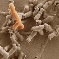 Bifidobacterium breve