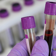 Blood samples in tubes