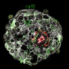 A human embryo in the lab at 9 days post-fertilisation