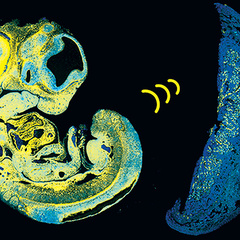 Dev-Cell-image-Sandovici