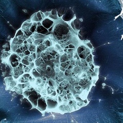 Human stem cell embedded in a 3D matrix, Cryo SEM