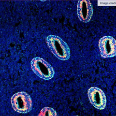 Uterine cells