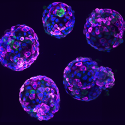 Human stem cell-based embryo model – Blastoids. Blue marks all nuclei, the green label marks cells of the inner cell mass, and the pink label is a readout of a ribosomal protein. Credit Irene Zorzan and Teresa Rayon, Babraham Institute.