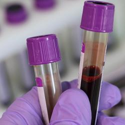 Blood samples in tubes