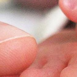 Mother is holding a tiny hand of her preterm baby that is in the NICU.  Credit: IvanJekic / E+ via Getty Images