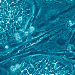 Human embryonic stem cells