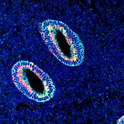 Uterine cells