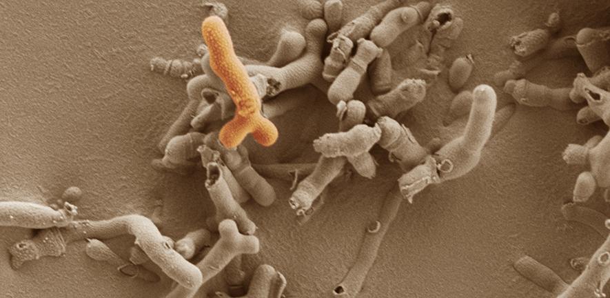Bifidobacterium breve Bifidobacterium breve