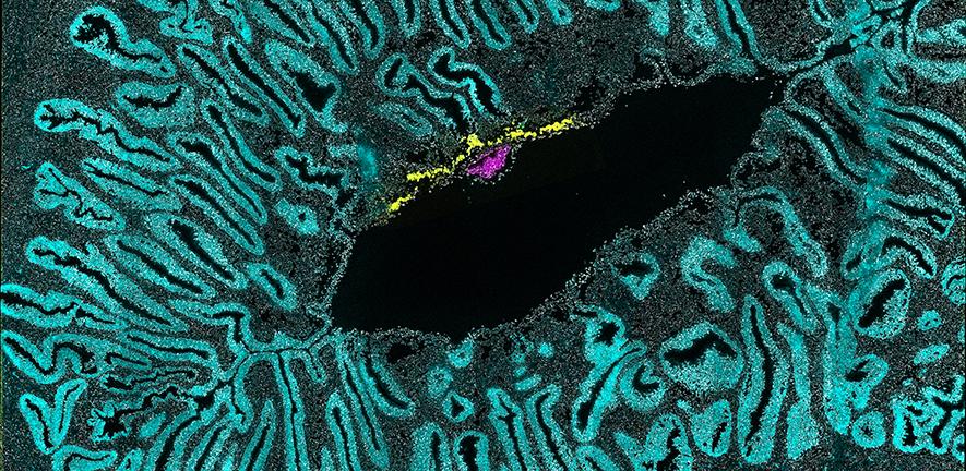 Marmoset embryo implanted within the uterus (image: University of Cambridge) Marmoset embryo implanted within the uterus (image: University of Cambridge)