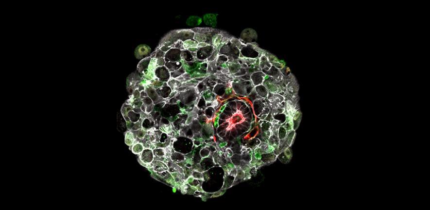 A human embryo in the lab at 9 days post fertilisation A human embryo in the lab at 9 days post-fertilisation