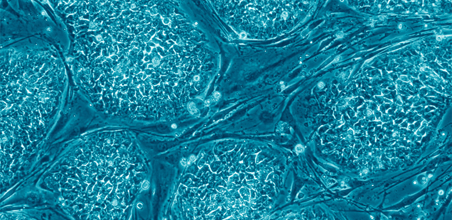Human embryonic stem cells Human embryonic stem cells