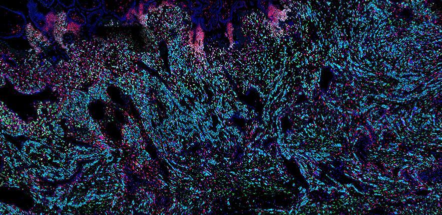 cells of the placenta. Credit: Kenny Roberts, Wellcome Sanger Institute cells of the placenta. Credit: Kenny Roberts, Wellcome Sanger Institute